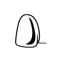 Diseño de Sonrisa en Cerámica